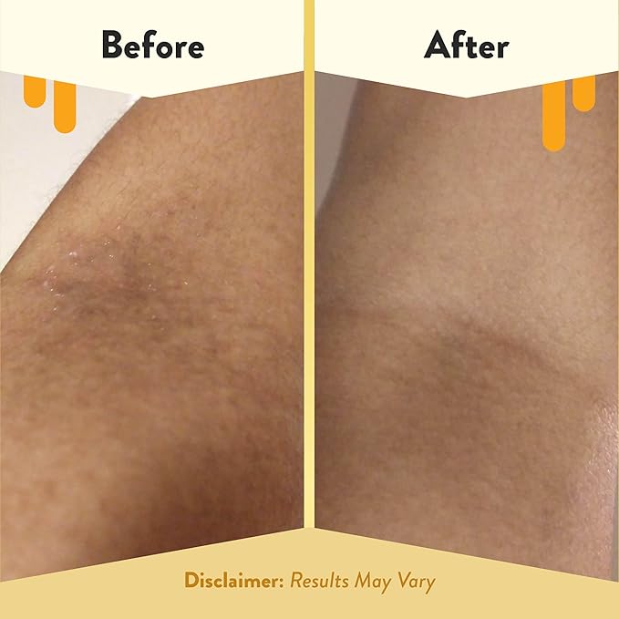 ECZEMA HONEY Fragrance-Free Oatmeal Comfort Bubble Bath - Sensitive Skin Body Wash & Bath Soak - Moisturizing Bath Products - Nourishing Bubble Bath for Women, Men, & Kids (12 Oz)